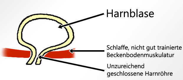 liebeskugeln beckenbodenmuskulatur beckenbodentraining harninkontinenz inkontinenz blase 